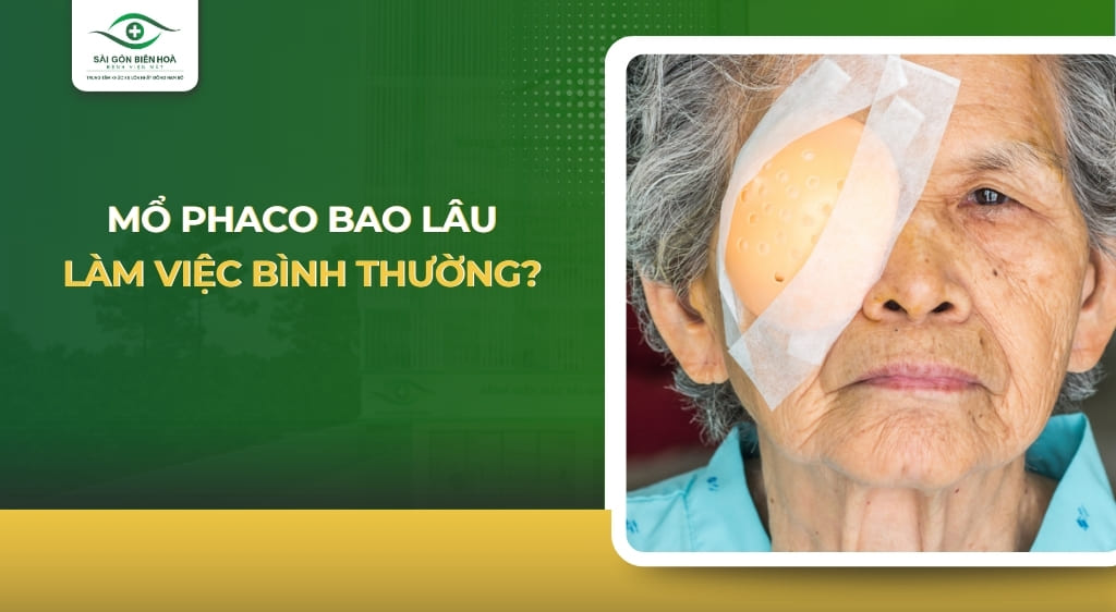 Mổ Phaco bao lâu làm việc bình thường