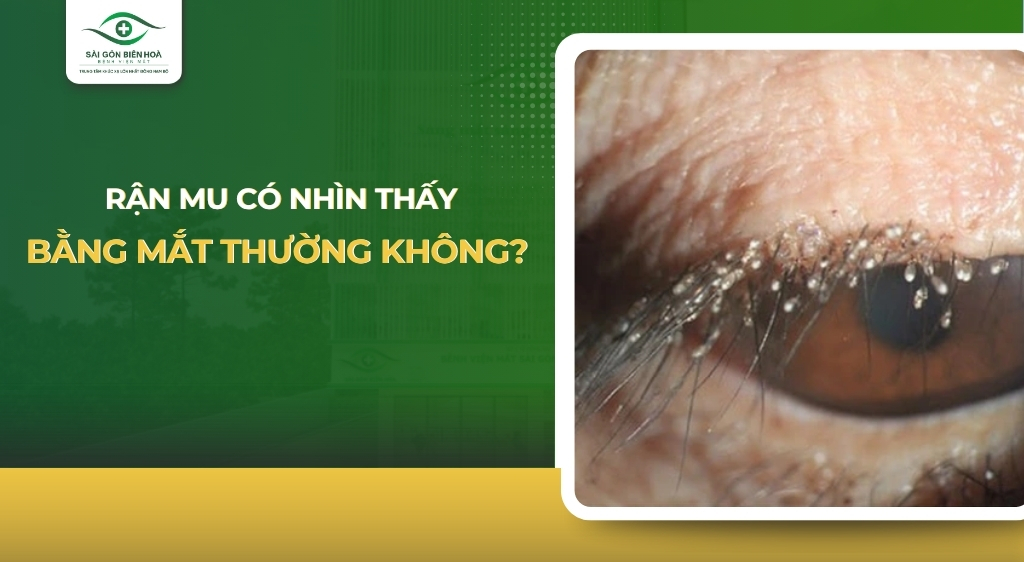 rận mu có nhìn thấy bằng mắt thường không
