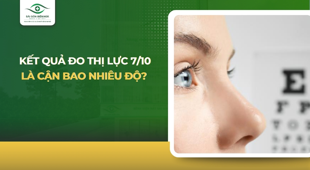 thị lực 7 10 là cận bao nhiêu độ