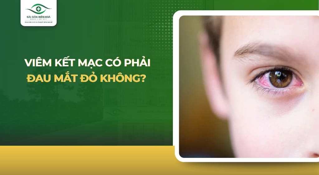 viêm kết mạc có phải đau mắt đỏ không