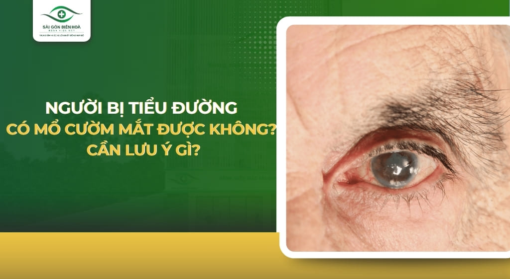 Bị tiểu đường có mổ cườm mắt được không