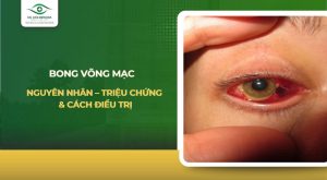Bong võng mạc