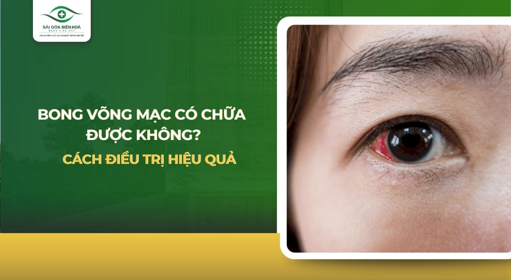 Bong võng mạc có chữa được không
