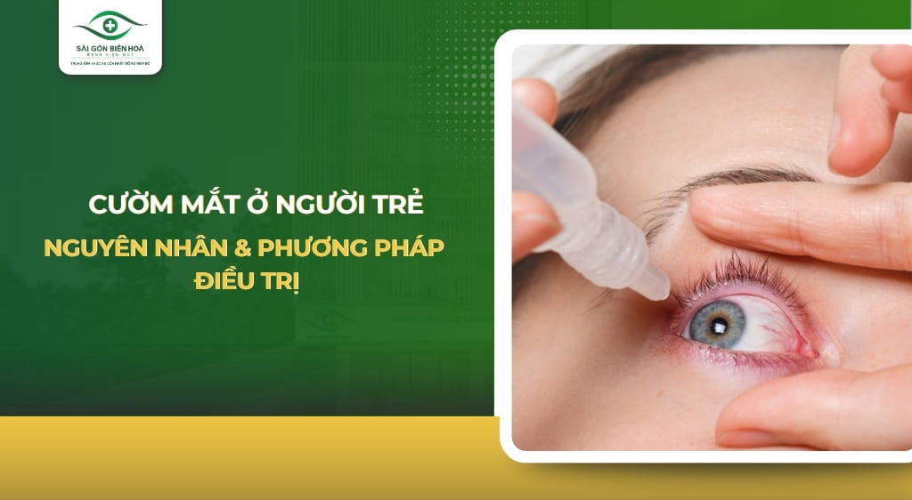 Cườm mắt ở người trẻ