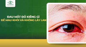 đau mắt đỏ kiêng gì