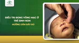 Điều trị bong võng mạc ở trẻ sinh non