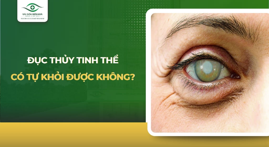 đục thuỷ tinh thể có tự khỏi được không