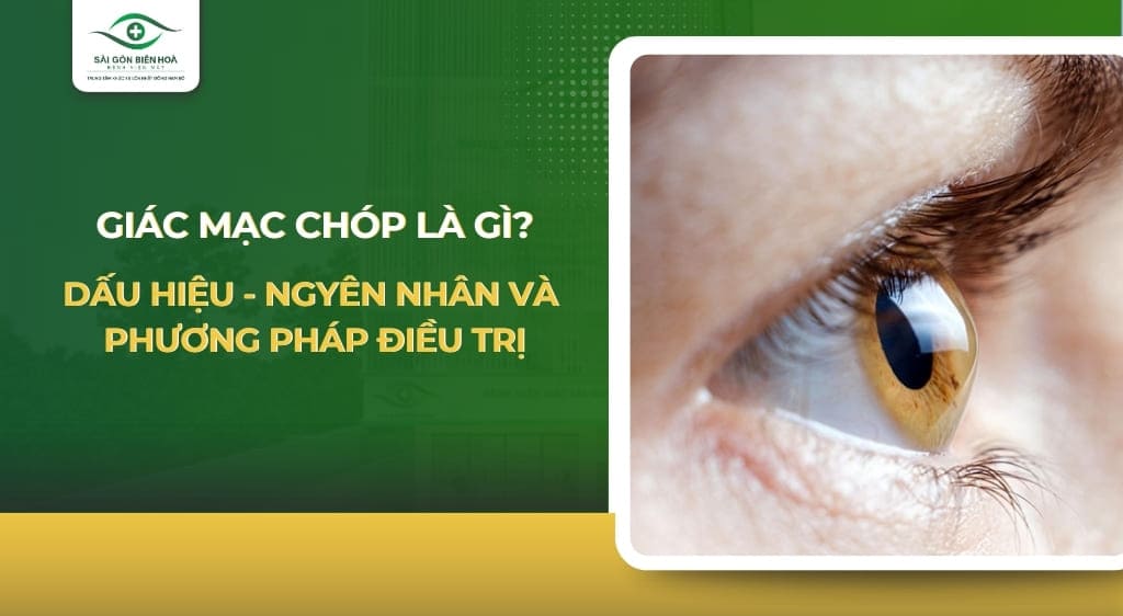 Giác mạc chóp