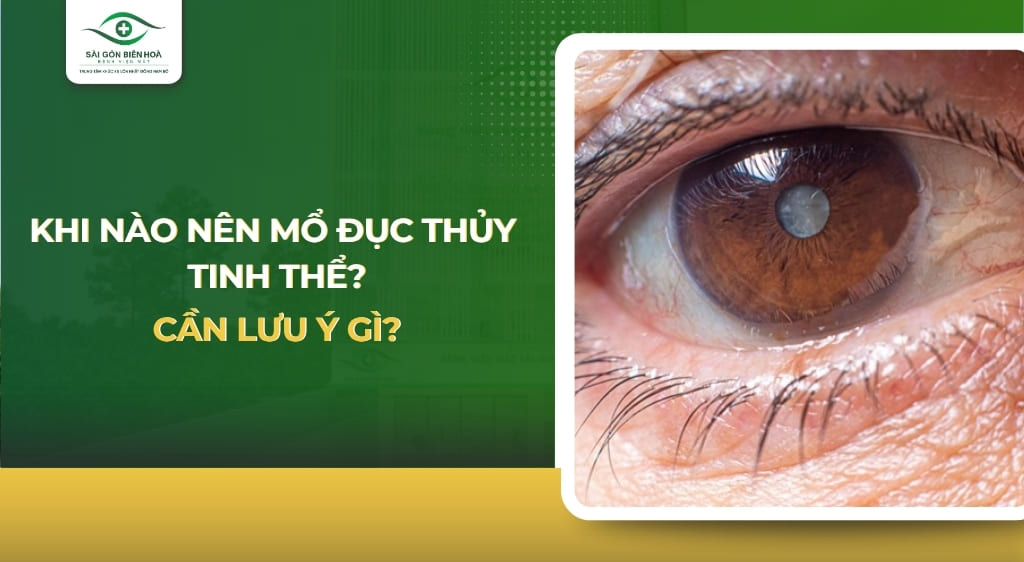 Khi nào nên mổ đục thủy tinh thể