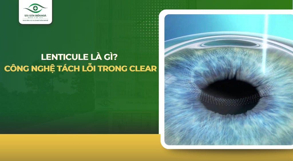 lenticule
