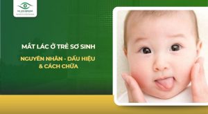 Mắt lác ở trẻ sơ sinh