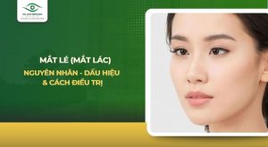 Mắt lé