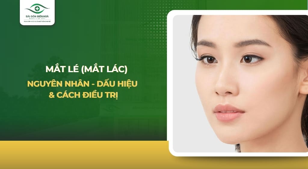 Mắt lé