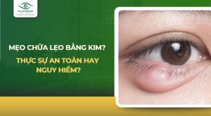 Mẹo chữa lẹo mắt bằng kim