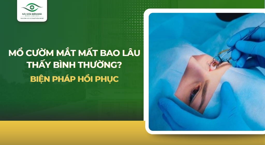 Mổ cườm mắt mất bao lâu