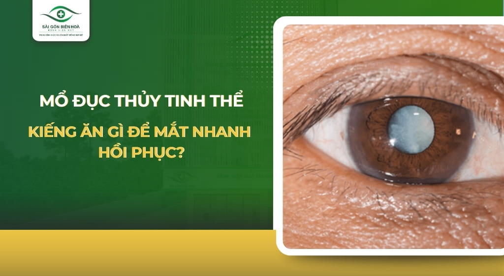 mổ đục thủy tinh thể kiêng ăn gì