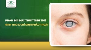 Phân độ đục thủy tinh thể