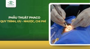 phẫu thuật phaco
