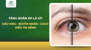 Tăng nhãn áp