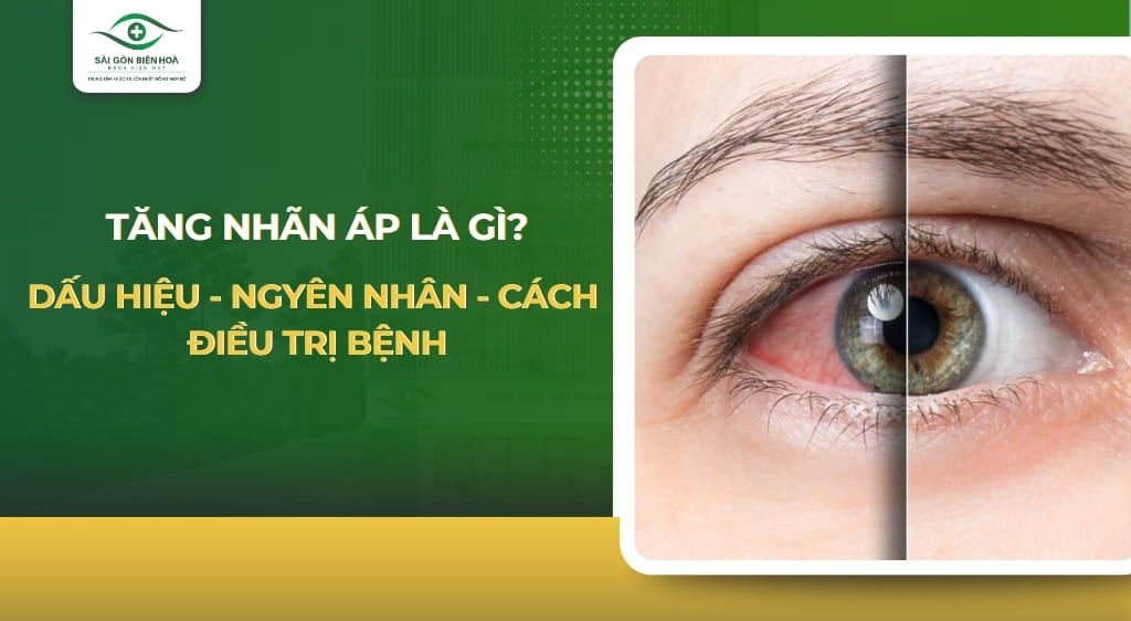 Tăng nhãn áp
