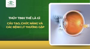 thủy tinh thể là gì