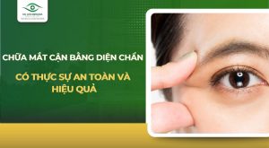 chữa mắt cận bằng điện chẩn