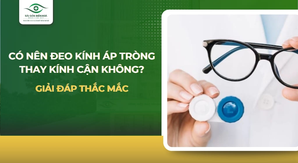 có nên đeo kính áp tròng thay kính cận