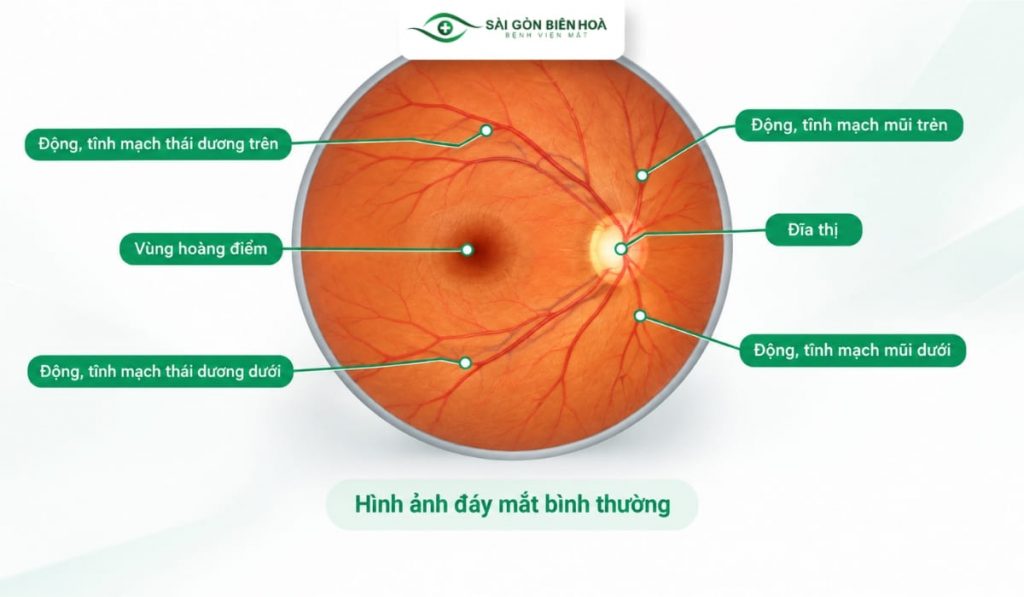 Hình ảnh soi đáy mắt bình thường