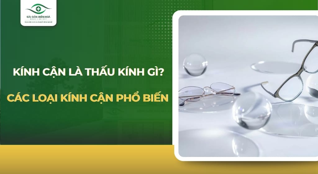 kính cận là thấu kính gì