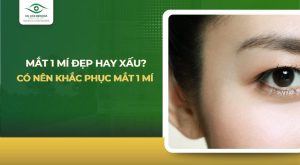 mắt 1 mí đẹp hay xấu​