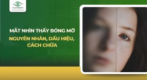 mắt nhìn thấy bóng mờ​