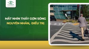 mắt nhìn thấy gợn sóng​