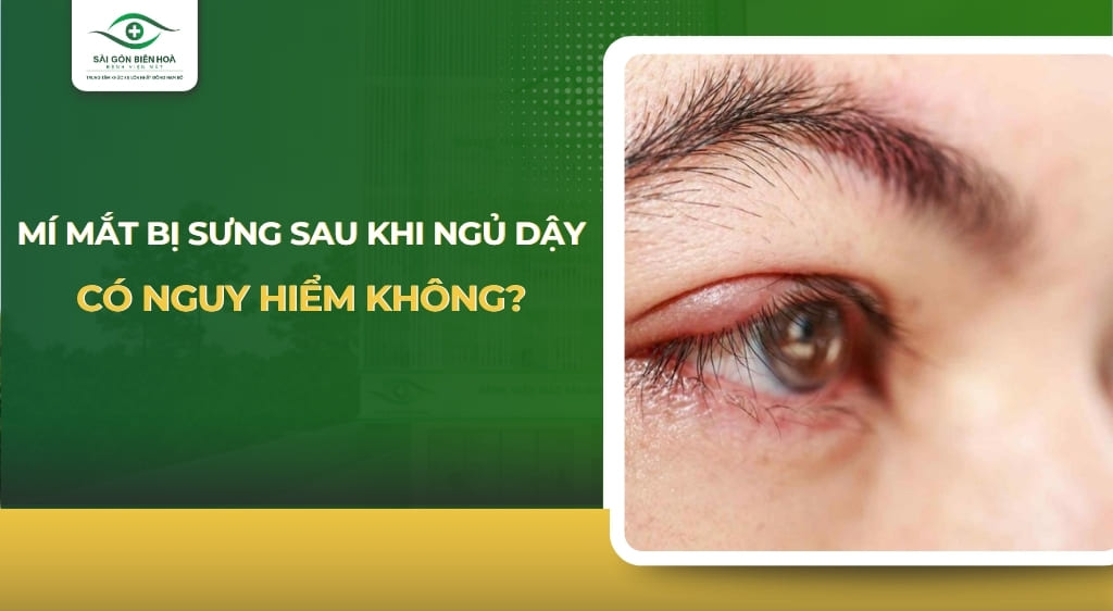 mí mắt bị sưng sau khi ngủ dậy