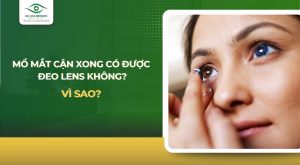 mổ mắt cận xong có được đeo lens không