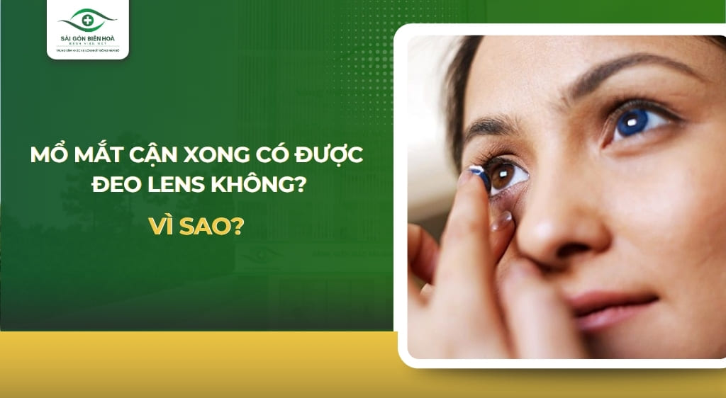 mổ mắt cận xong có được đeo lens không