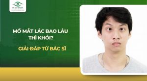 mổ mắt lác bao lâu thì khỏi