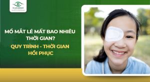 Mổ mắt lé mất bao nhiêu thời gian