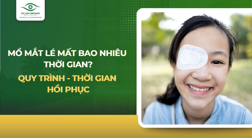 Mổ mắt lé mất bao nhiêu thời gian