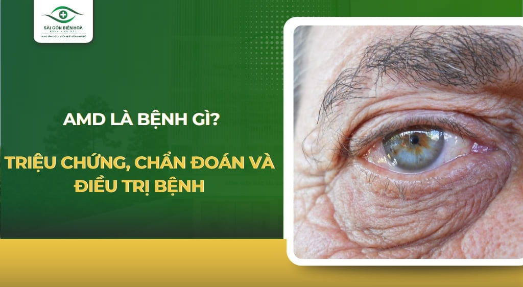 AMD là bệnh gì