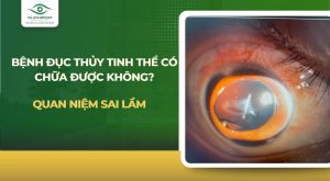 Bệnh đục thủy tinh thể có chữa dược không