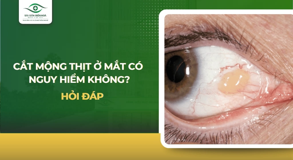 cắt mộng thịt ở mắt có nguy hiểm không