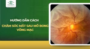 chăm sóc mắt sau mổ bong võng mạc