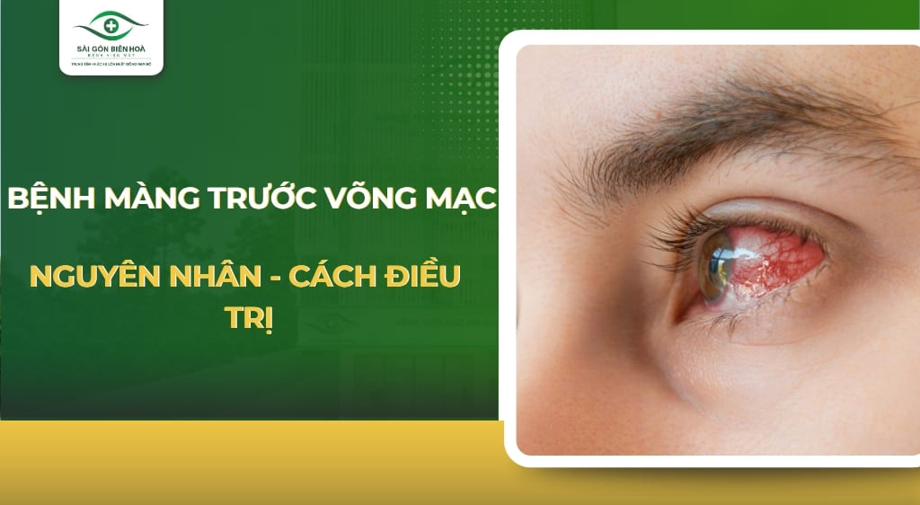 Màng trước võng mạc