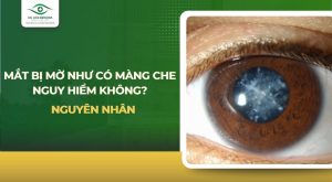 Mắt bị mờ như có màng che