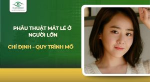 phẫu thuật mắt lé ở người lớn