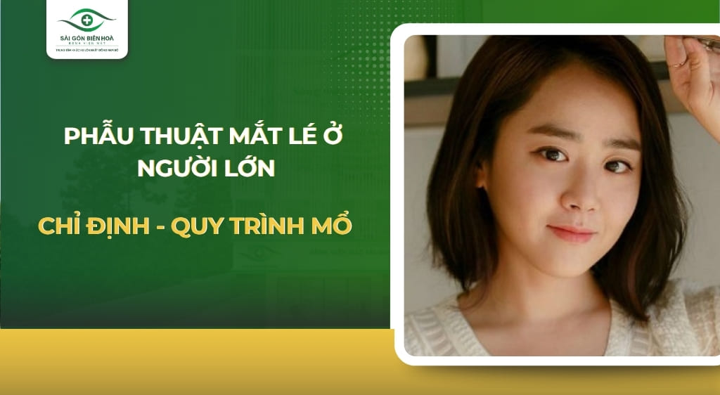phẫu thuật mắt lé ở người lớn