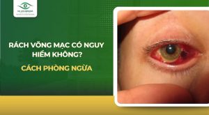 Rách võng mạc có nguy hiểm không