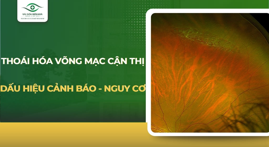 Thoái hóa võng mạc cận thị
