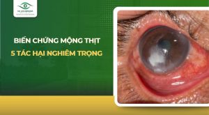 biến chứng mộng thịt