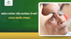 biến chứng tiểu đường ở mắt